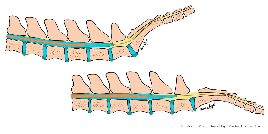 Tethered Cord Syndrome: From Literature to Experience